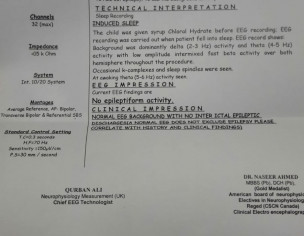 Brain Problem