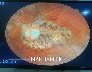 Eye Nazar Nahi Atha 
