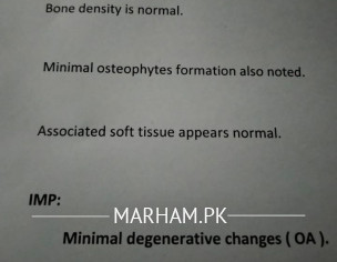 Knee Problm