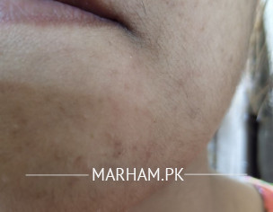 Skin Problem