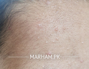 Skin Problem