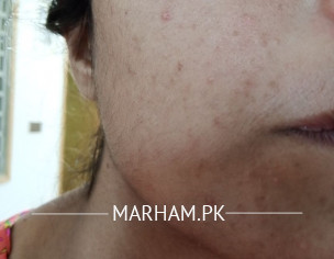 Skin Problem
