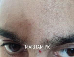 Skin Problem