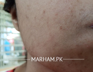 Skin Problem