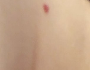 Red Mole