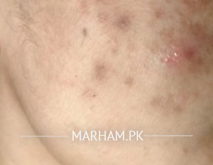 Spots