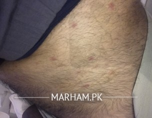 E Red Spots On My Stomach