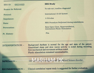 Brain EEG