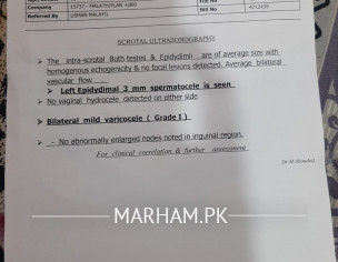 Varicocele Problem
