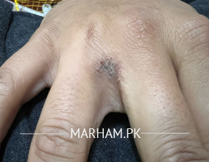 Skin Problem 