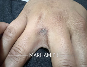 Skin Problem 