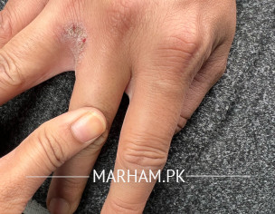 Skin Problem 