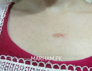 Skin Problem
