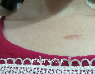 Skin Problem