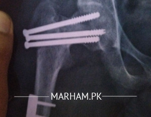 Ortho Related Problem