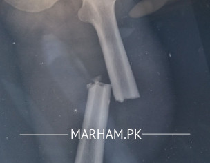 Ortho Related Problem