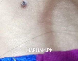 Mole