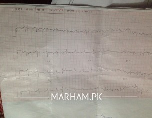 Cardio (Heart) Problem