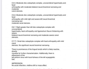 Parkinson Plus