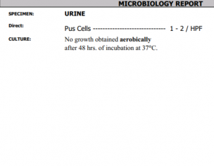 Urine