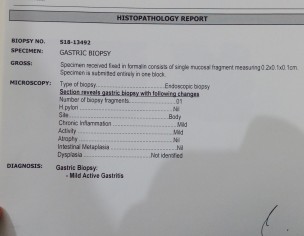 Hiatal Hernia