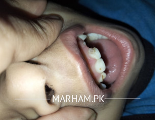 Tooth Teeth
