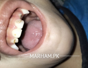 Tooth Teeth