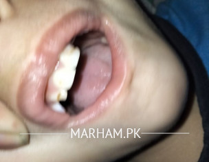 Tooth Teeth