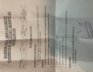 Left Knee Pain