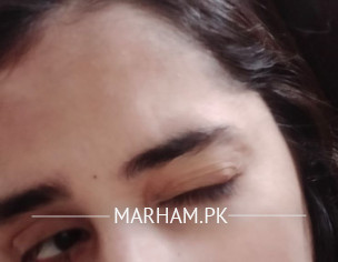 Eye Problem