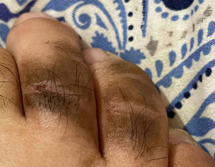 Skin Problem