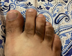 Skin Problem
