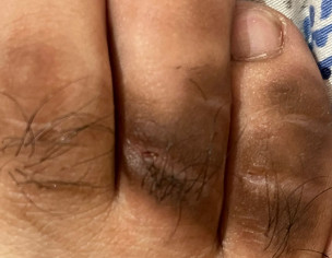 Skin Problem