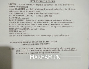 Gallbladder Stone