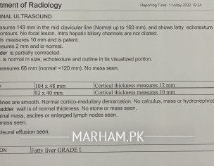 Fatty Liver