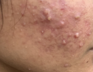 Skin Problem