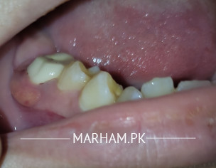 Teeth