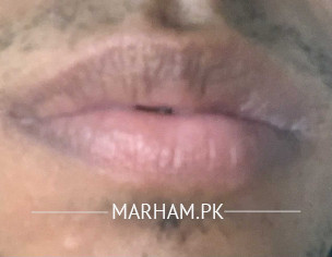Lips Borders Black 