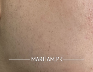 Dermatologist ONLY! 