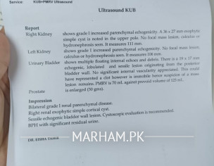 Prostate Ca