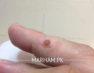 Wary On Finger 