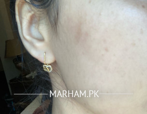 Face Skin Problem