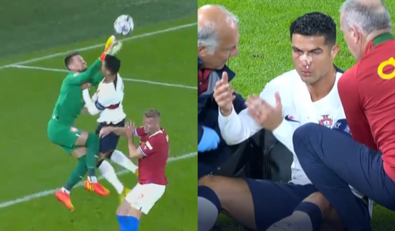 El golpazo que Cristiano Ronaldo recibio incluso le hizo sangrar la nariz | Foto: AFP