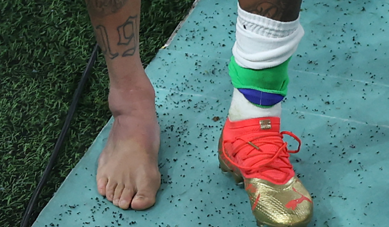 Neymar salió lesionado del juego ante Serbia. Foto: AFP