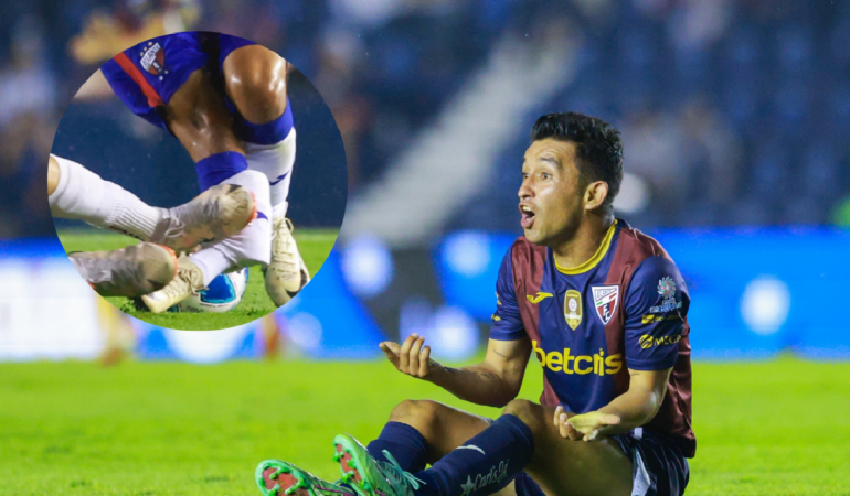 Christian Bermúdez recibe fuerte barrida
