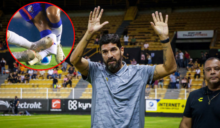 Sebastián Abreu aceptó que estas lesiones forman parte de los gajes del oficio