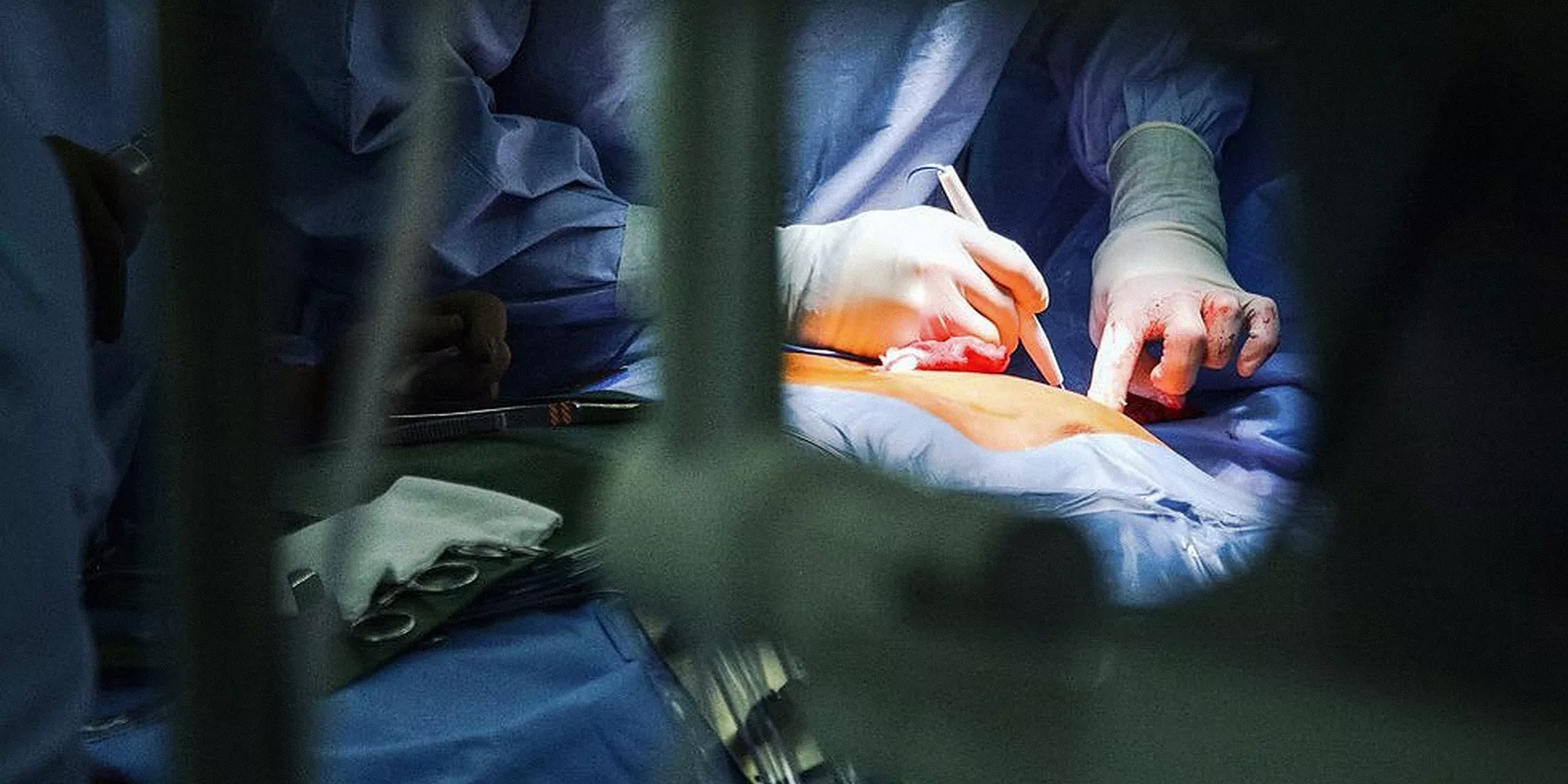 Операционная прибыль