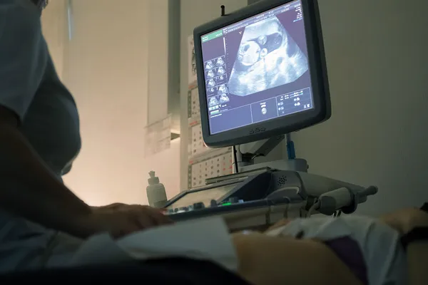 Если в России запретить аборты, будут ли женщины больше рожать?