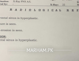 Difficulty In Breathing 