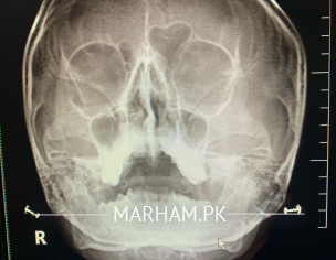 Difficulty In Breathing 